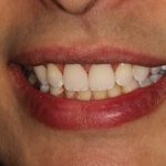 Smile at Nutting Dentistry Knoxville TN